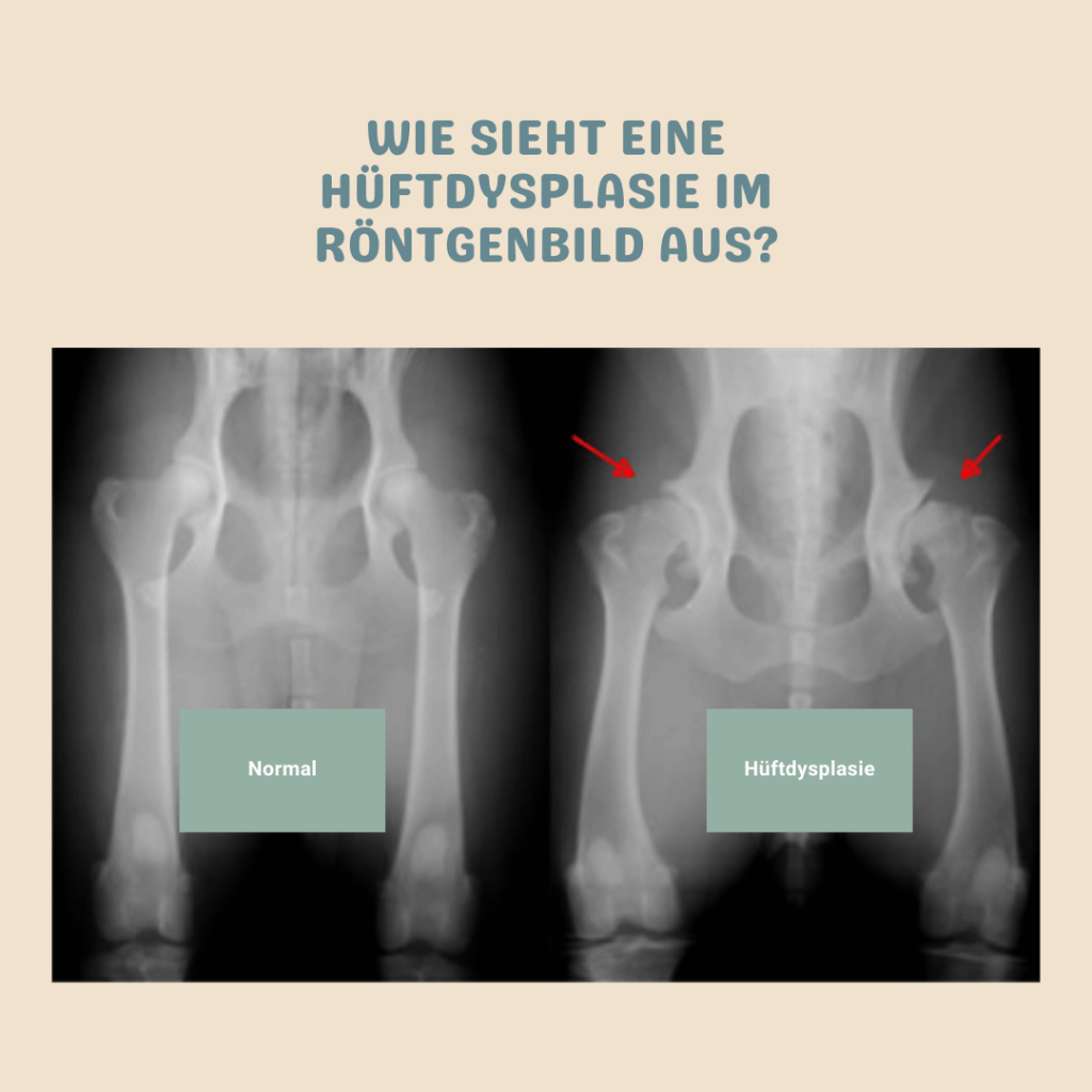 Hüftdysplasie